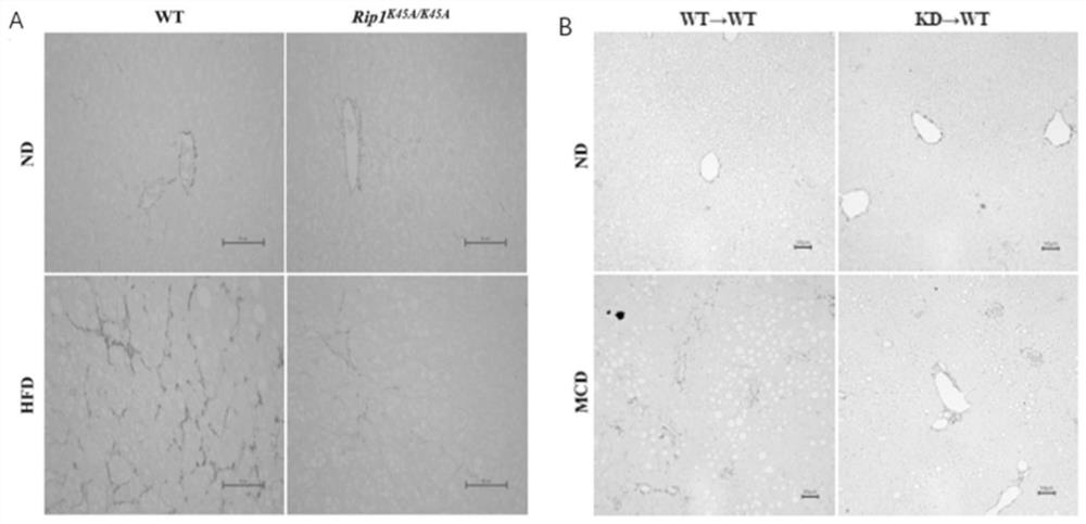 Application of macrophage-targeting RIPK1 and RIPK1 inhibitor in screening and preparing liver injury diagnosis and treatment medicine