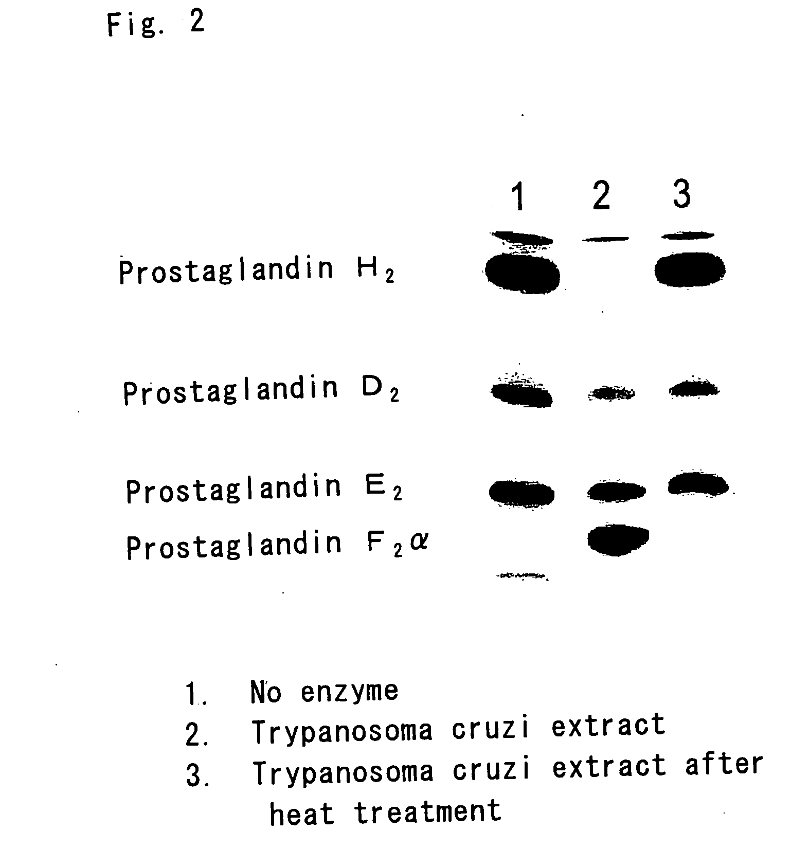 Flavin protein of trypanosoma cruzi, method of screening vermicide with the use of the same and diagnostic