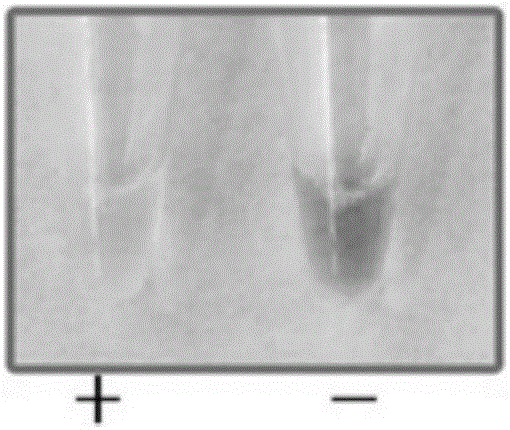 A kind of loop-mediated isothermal amplification primer composition and application thereof for detecting flat head anthracnose