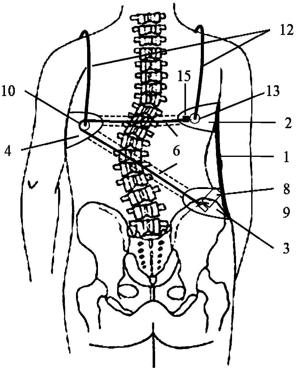 Intelligent spine orthosis with dynamic regulation and control functions of correction force system