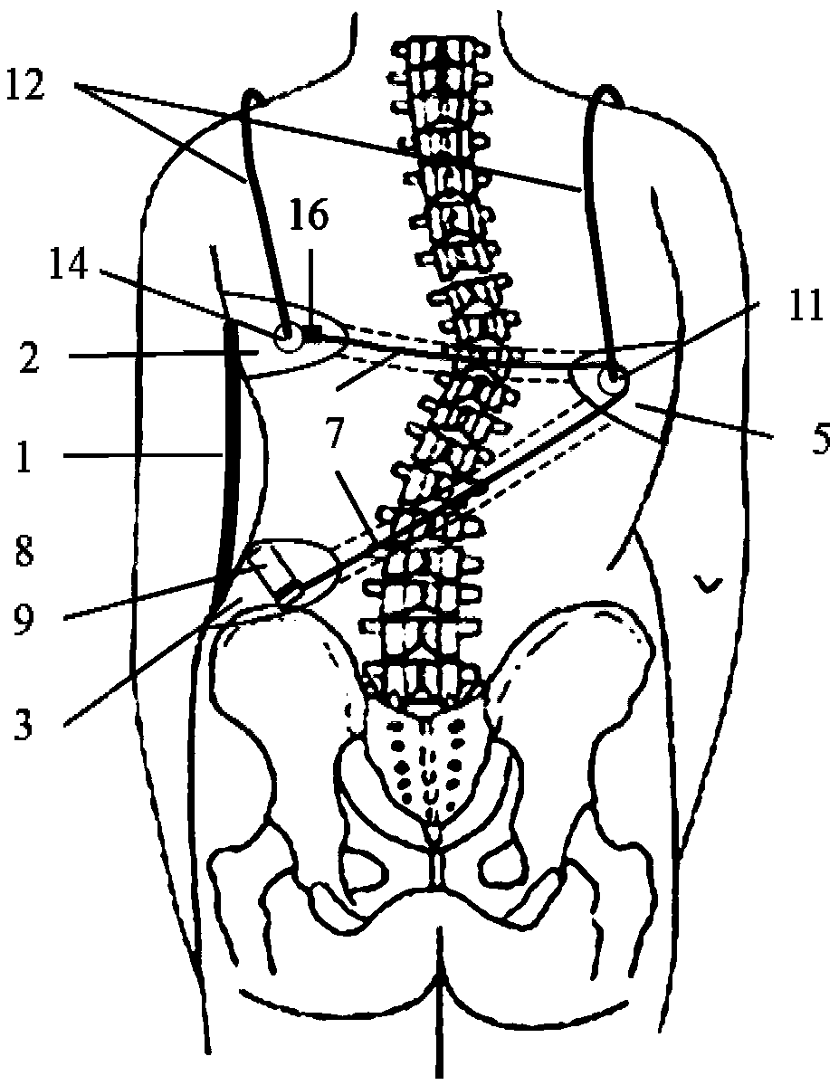 Intelligent spine orthosis with dynamic regulation and control functions of correction force system