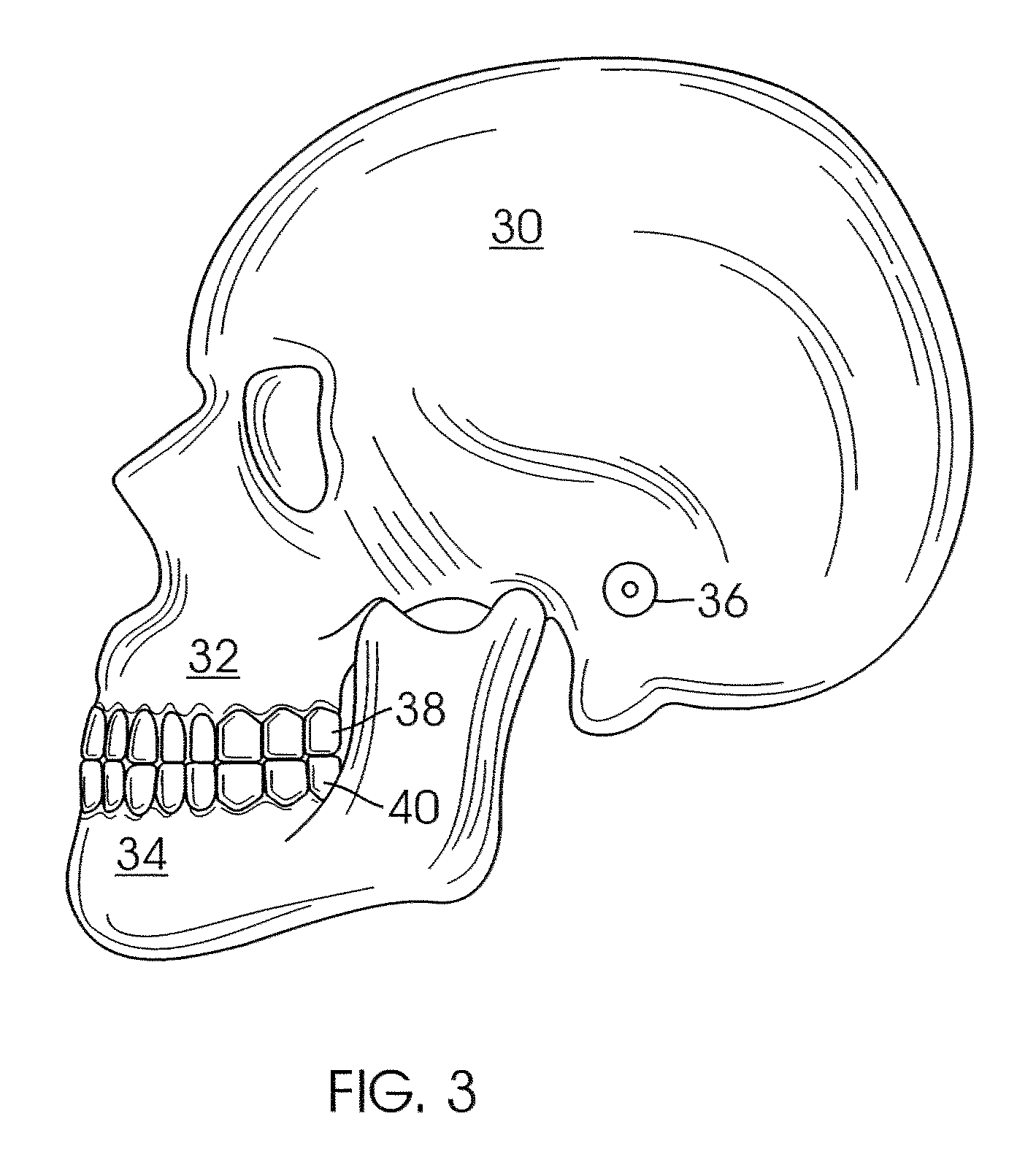 System and method for digital tooth imaging