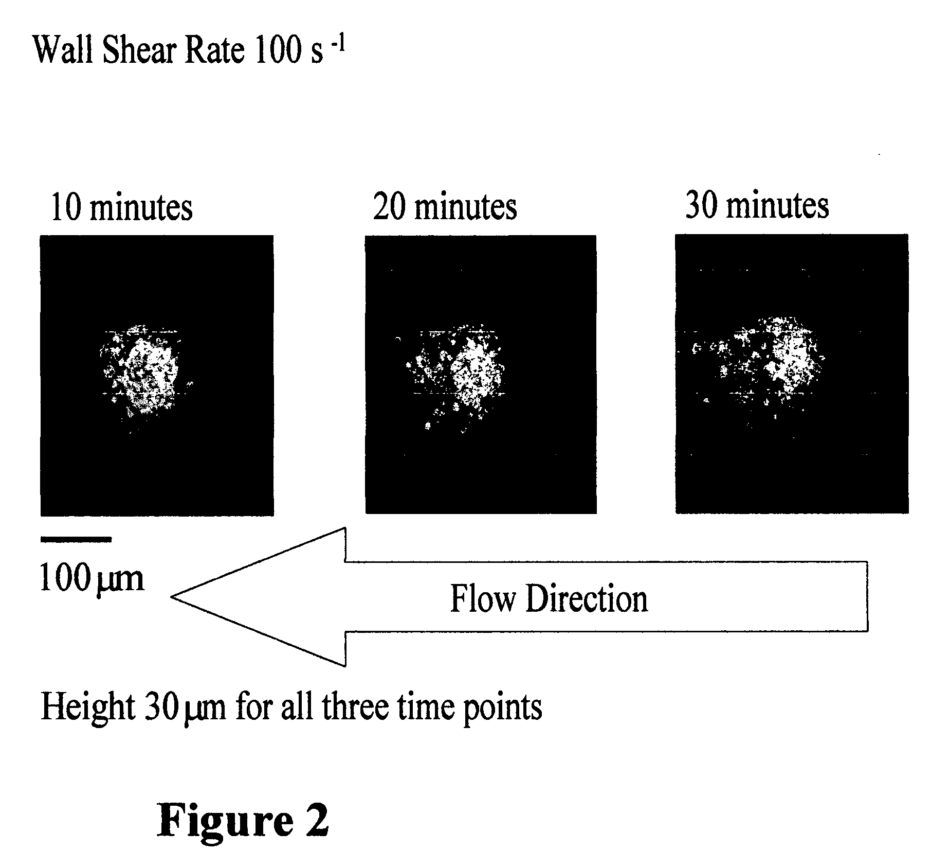 Apparatus and method to measure platelet contractility