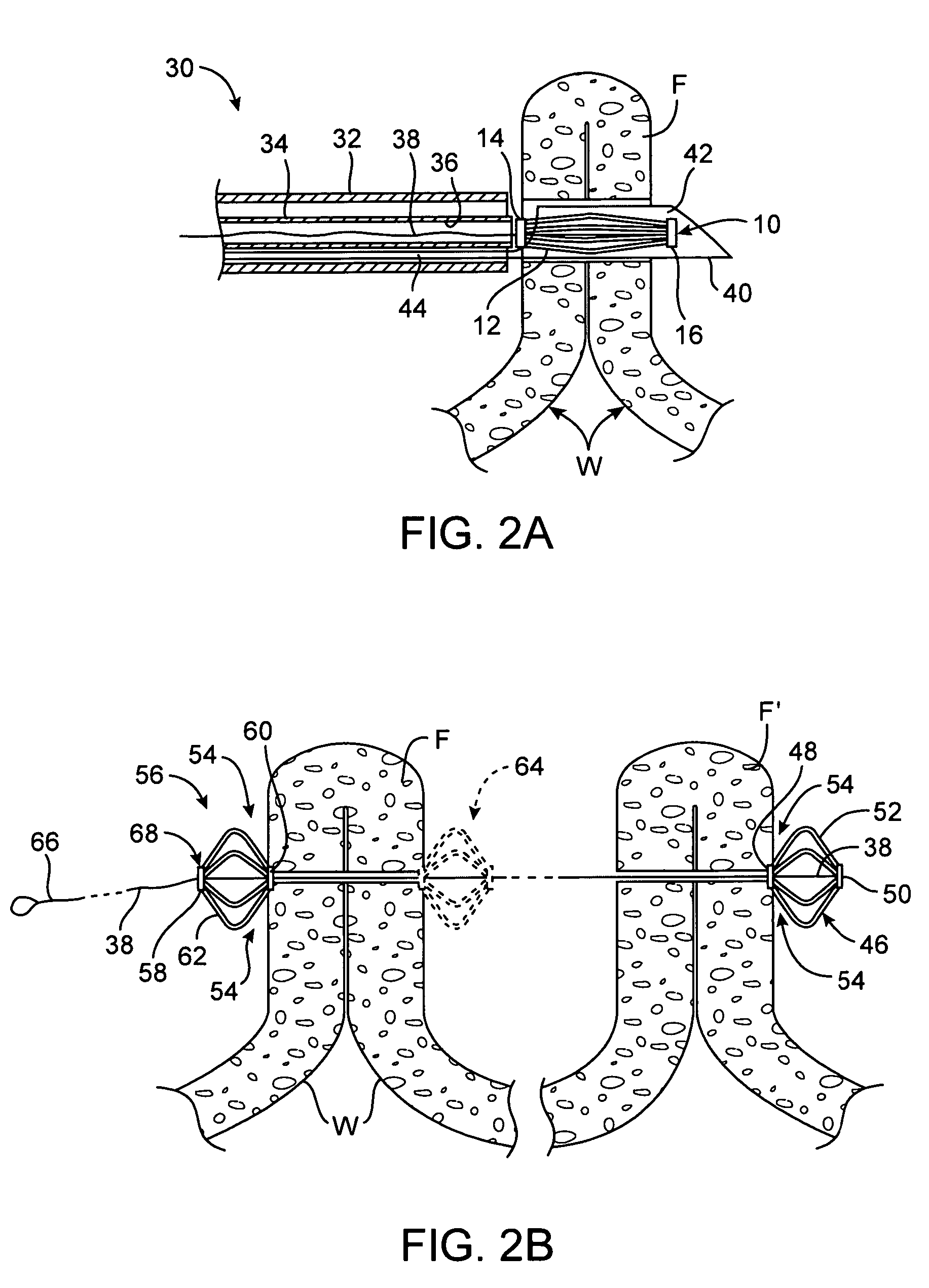 System for optimizing anchoring force