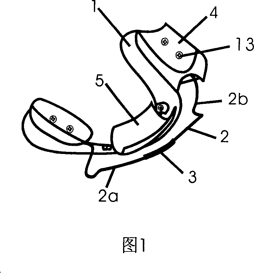 Oral cavity function orthopetical device and its mounting process