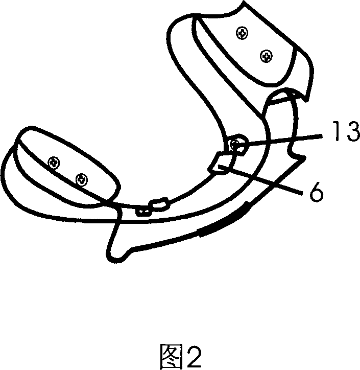 Oral cavity function orthopetical device and its mounting process