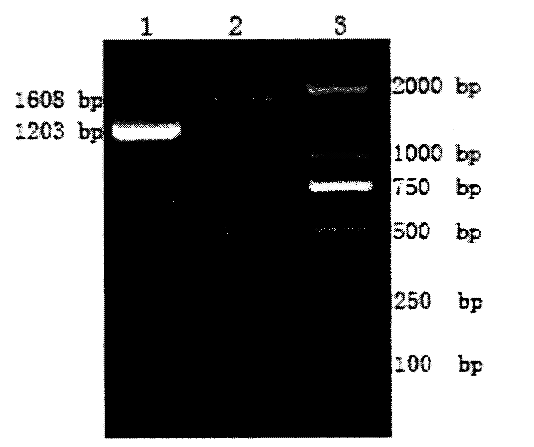 Compound type therapeutic hepatitis B gene vaccine and construction method thereof