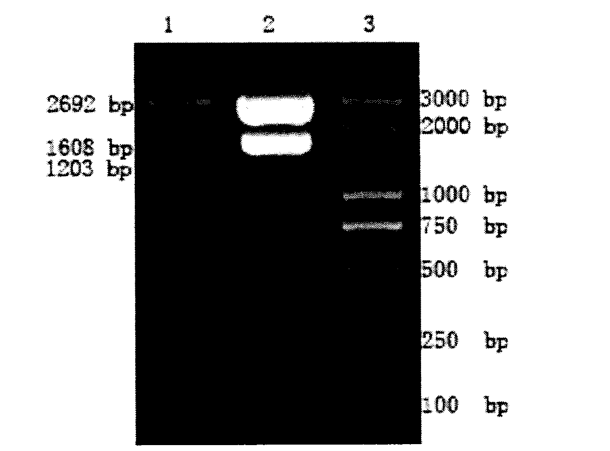 Compound type therapeutic hepatitis B gene vaccine and construction method thereof