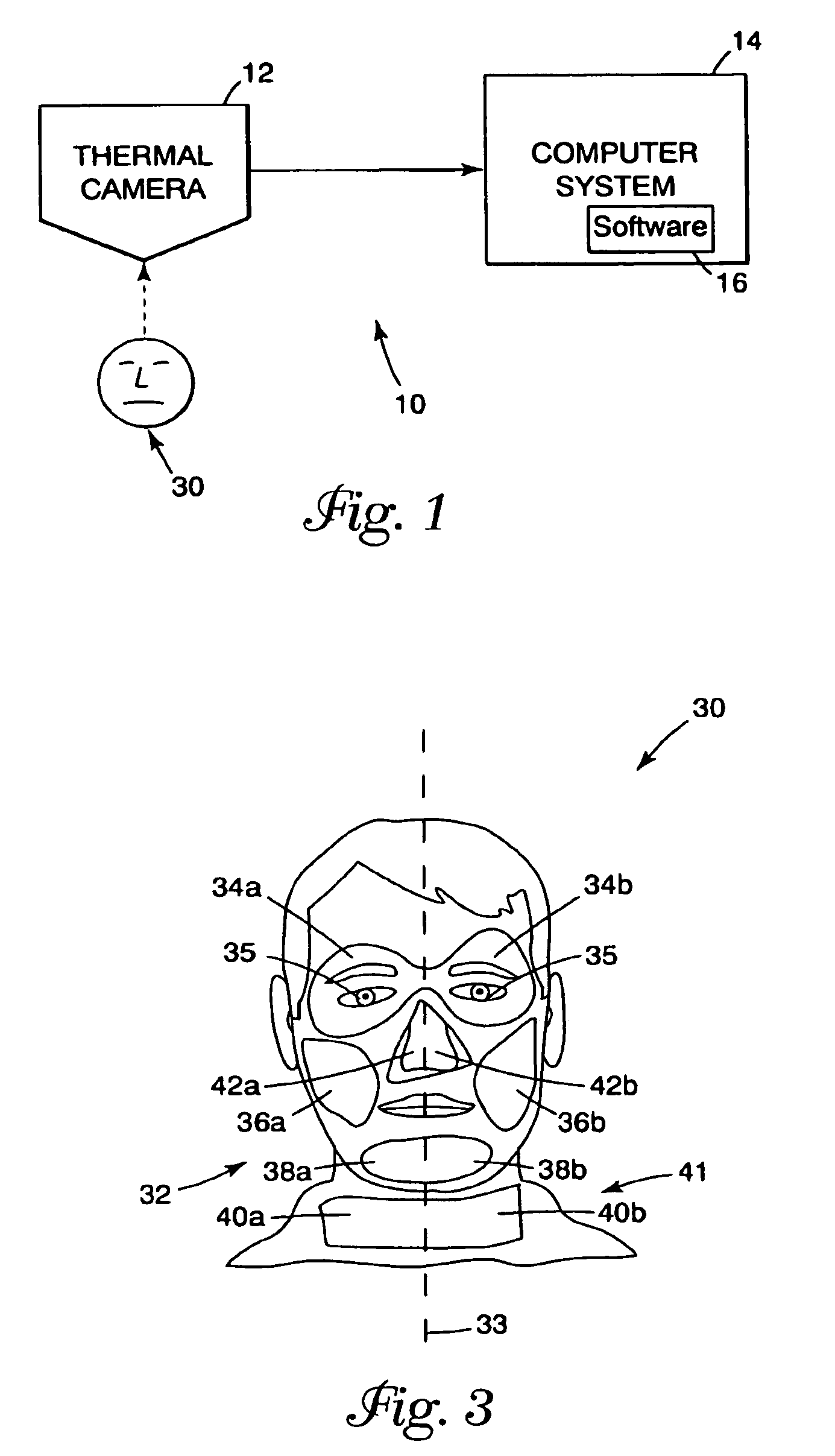Detection system and method using thermal image analysis