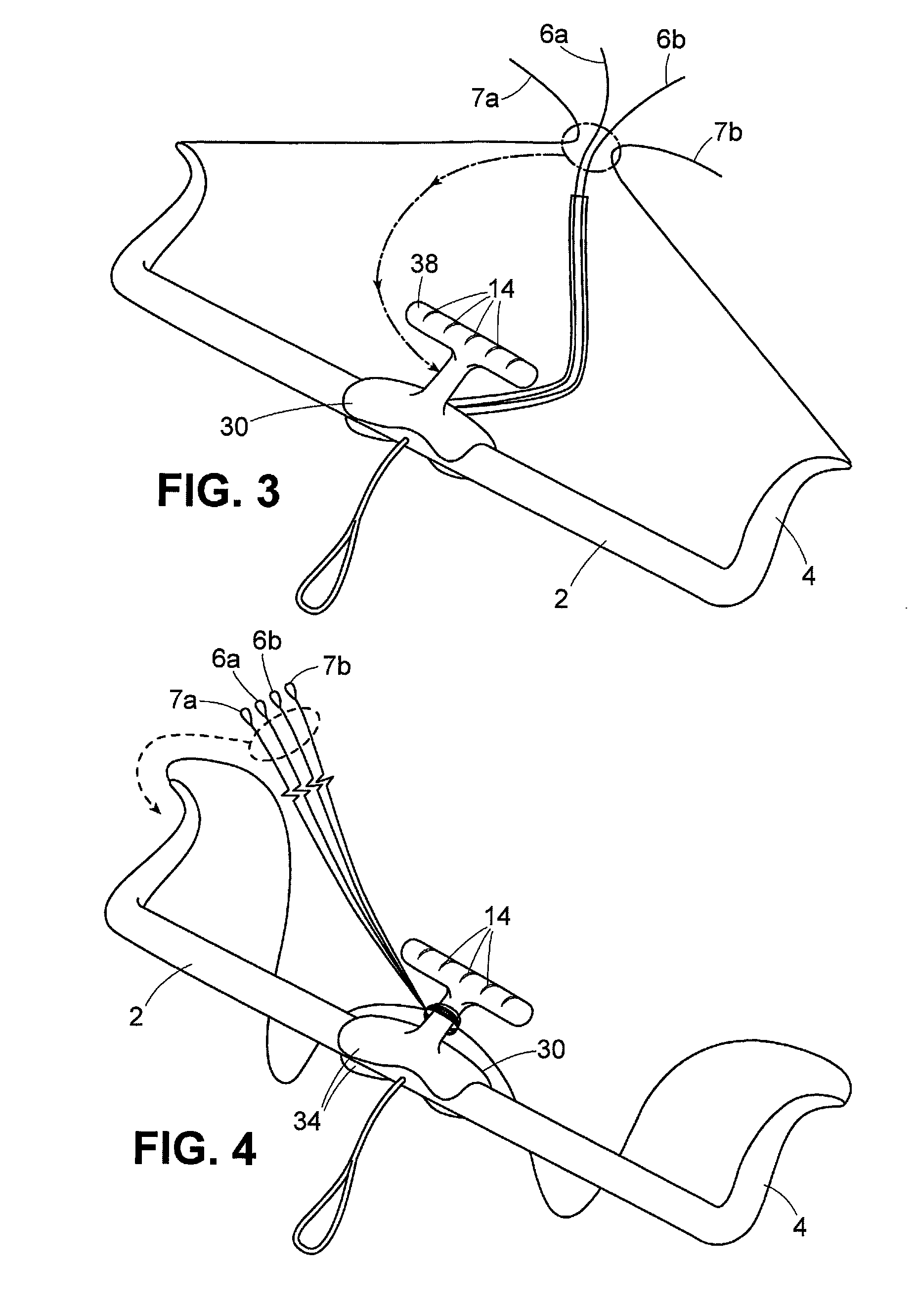 Detachable Line Management Device for Traction Kites