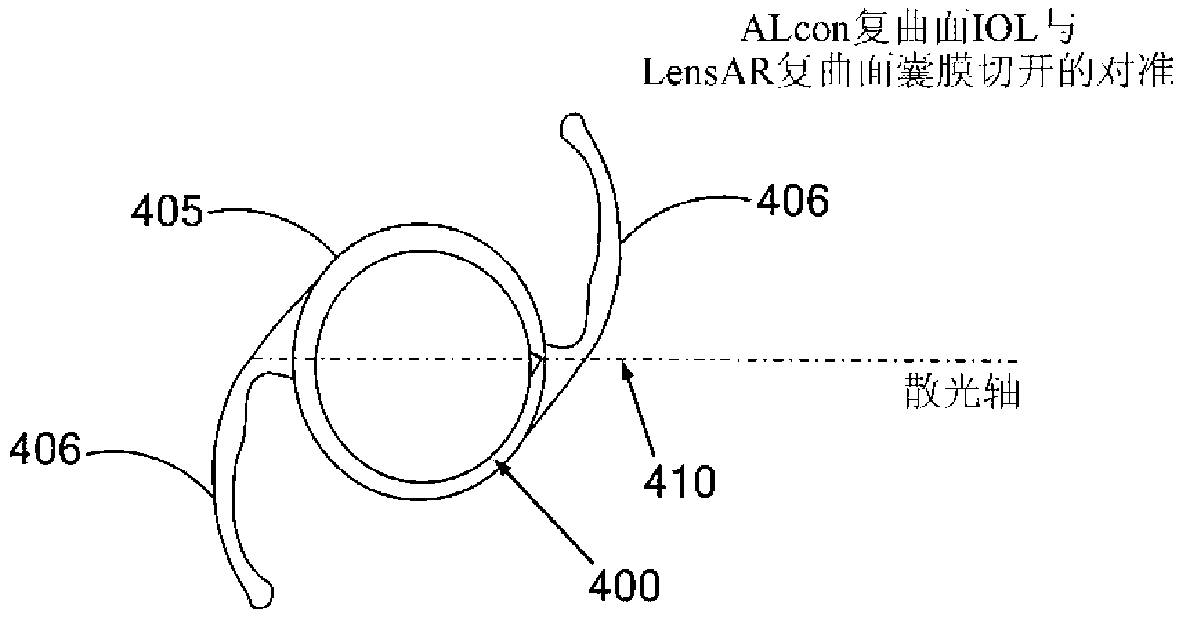 Placido ring measurement of astigmatism axis and laser marking of astigmatism axis