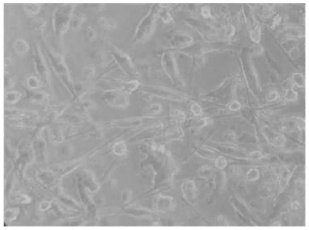 Tumor composite antigen, dendritic cell multivalent vaccine and application of dendritic cell multivalent vaccine