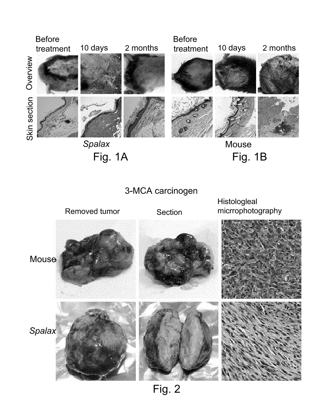 Spalax fibroblast-derived Anti-cancer agents