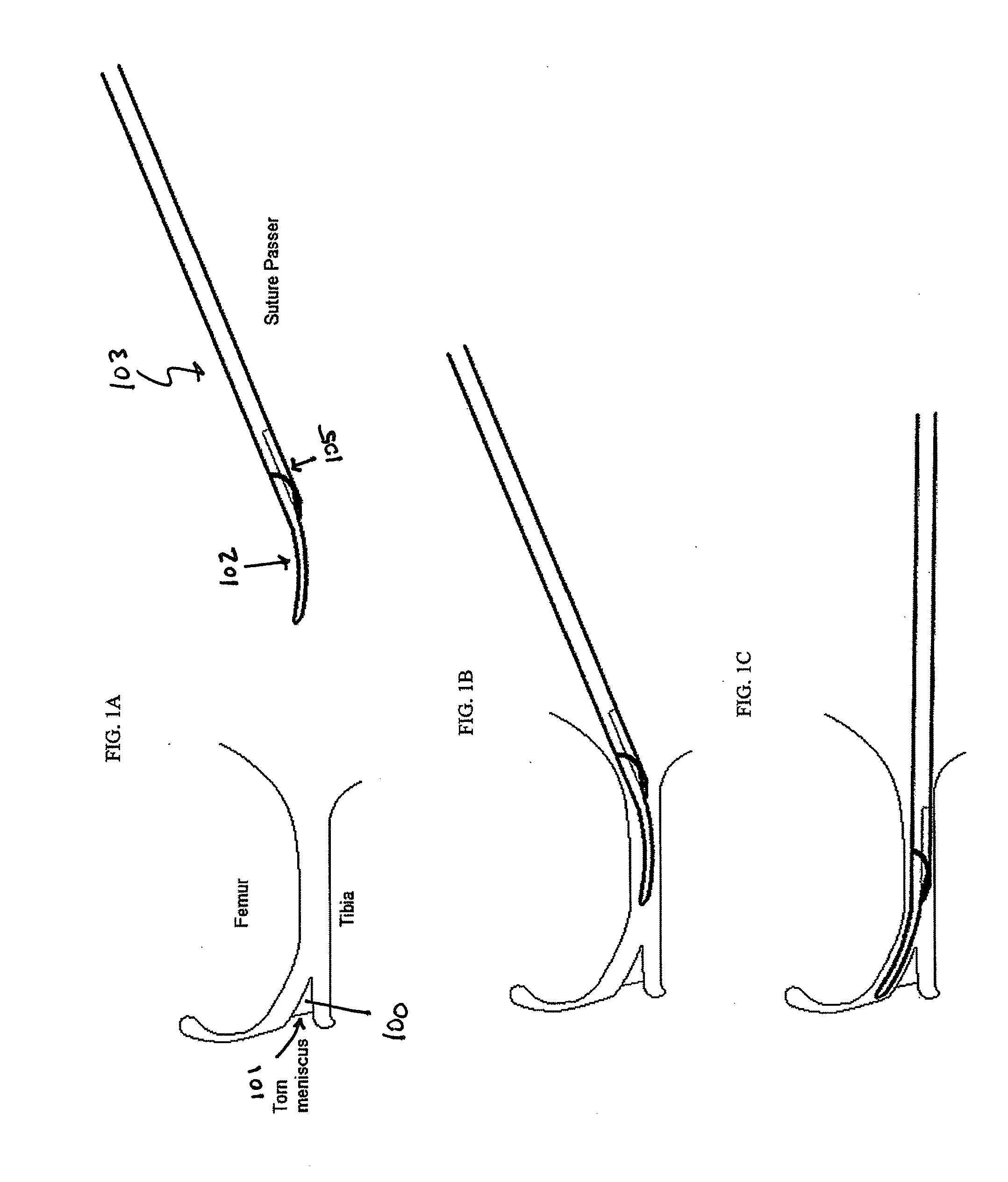 Devices, systems and methods for meniscus repair