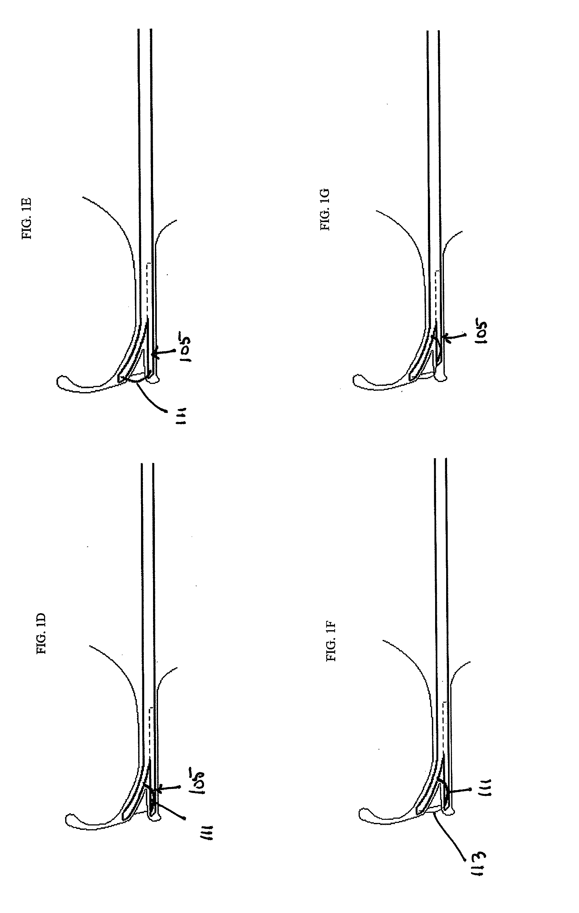 Devices, systems and methods for meniscus repair