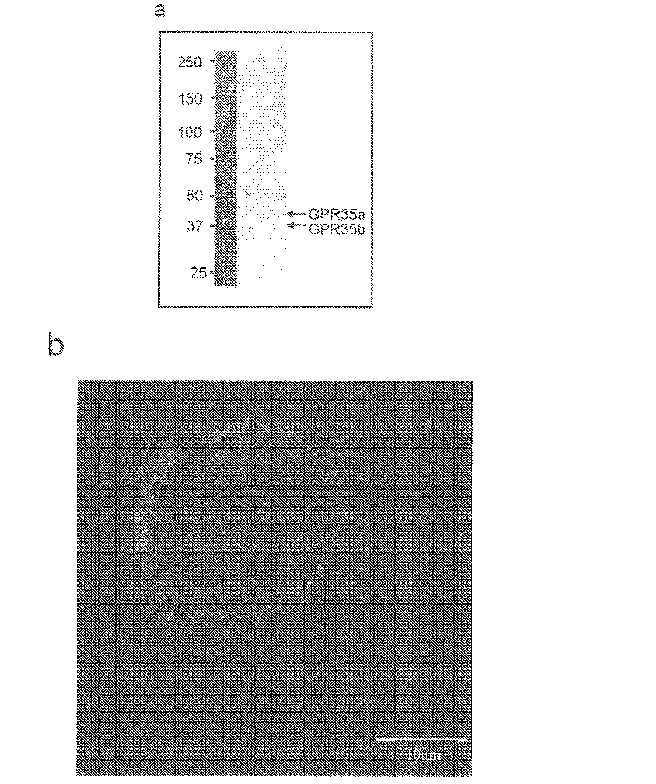 Compositions and methods for the treatment of pathological condition(s) related to GPR35 and/or GPR35-HERG complex