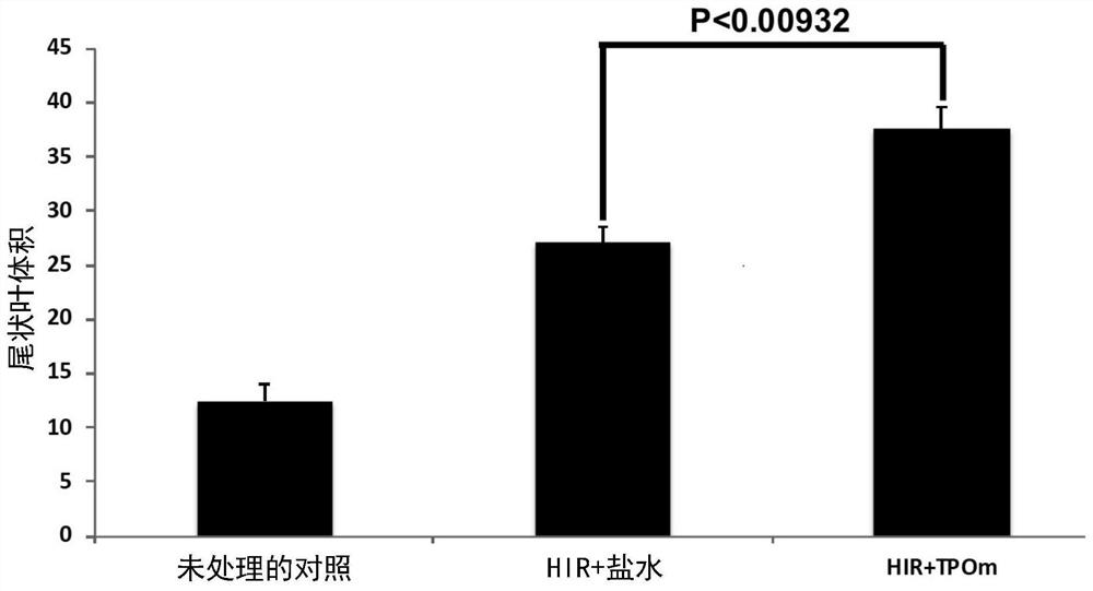 Methods for mitigating liver injury and promoting liver hypertrophy, regeneration and cell engraftment in conjunction with radiation and/or radiomimetic treatments