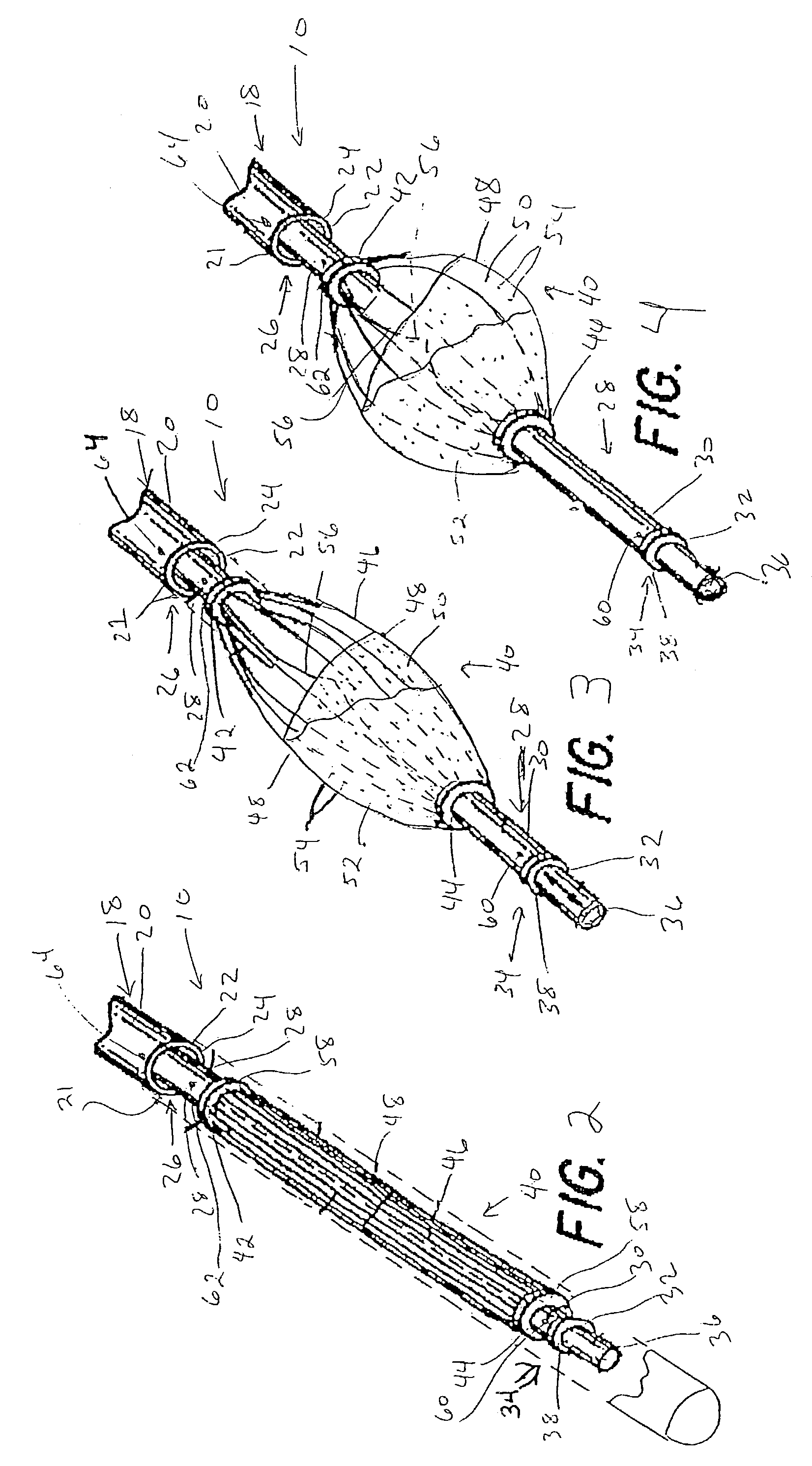 Apparatus for trapping emboli