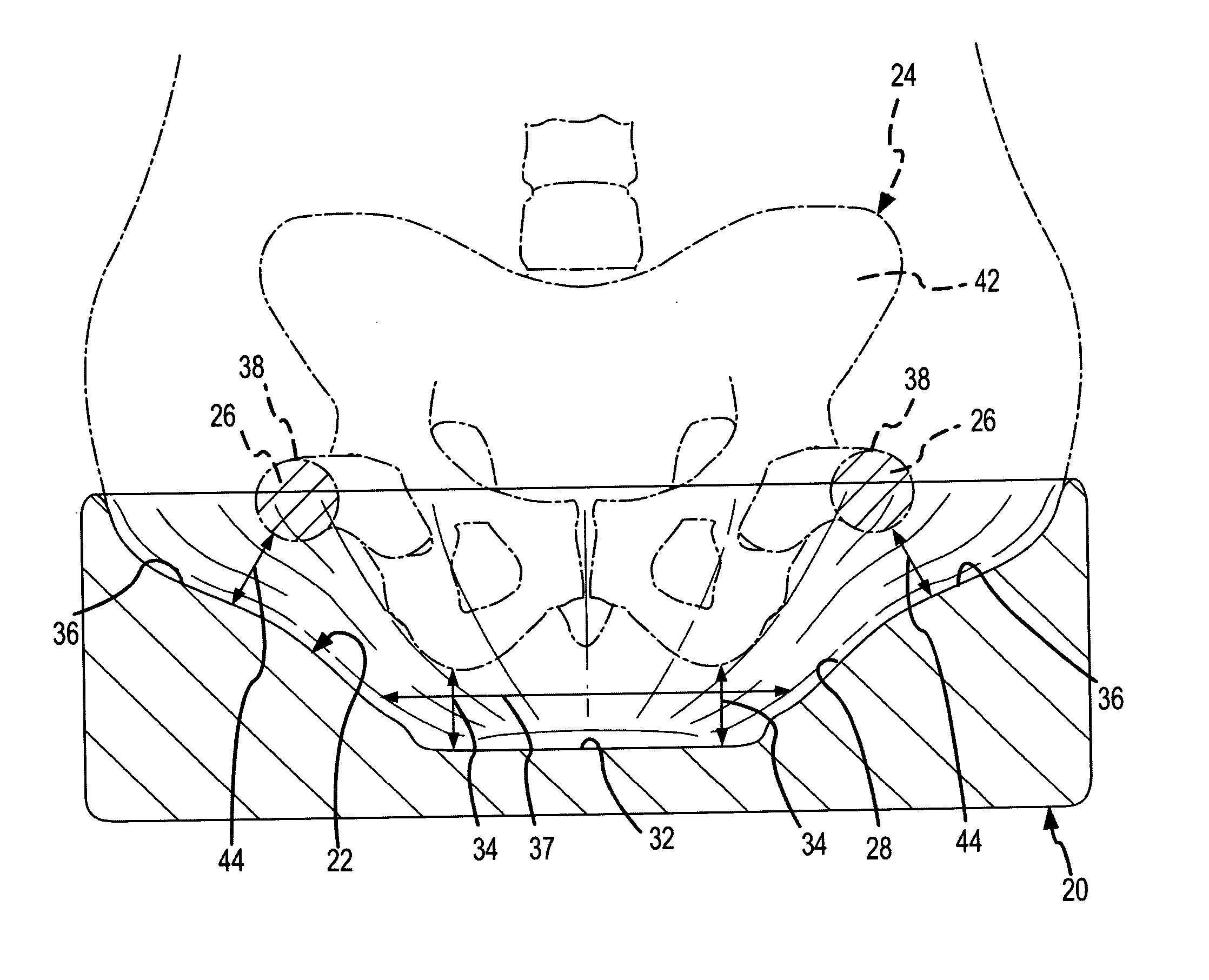Contoured seat cushion and method for offloading pressure from skeletal bone prominences and encouraging proper postural alignment