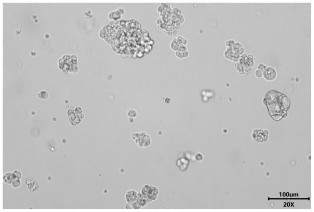 A kind of compound enzyme digestive liquid and its preparation method and application