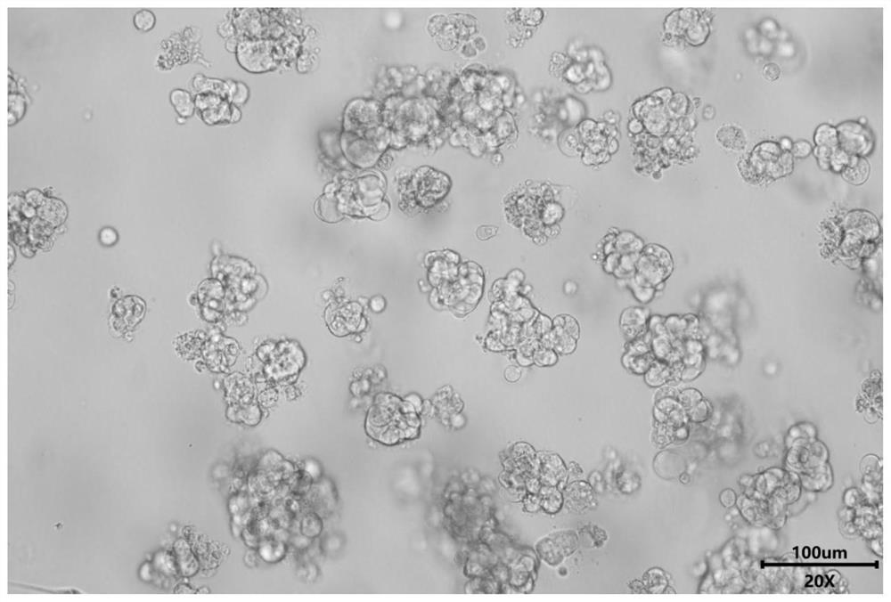 A kind of compound enzyme digestive liquid and its preparation method and application