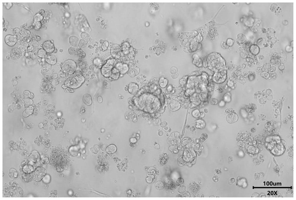 A kind of compound enzyme digestive liquid and its preparation method and application