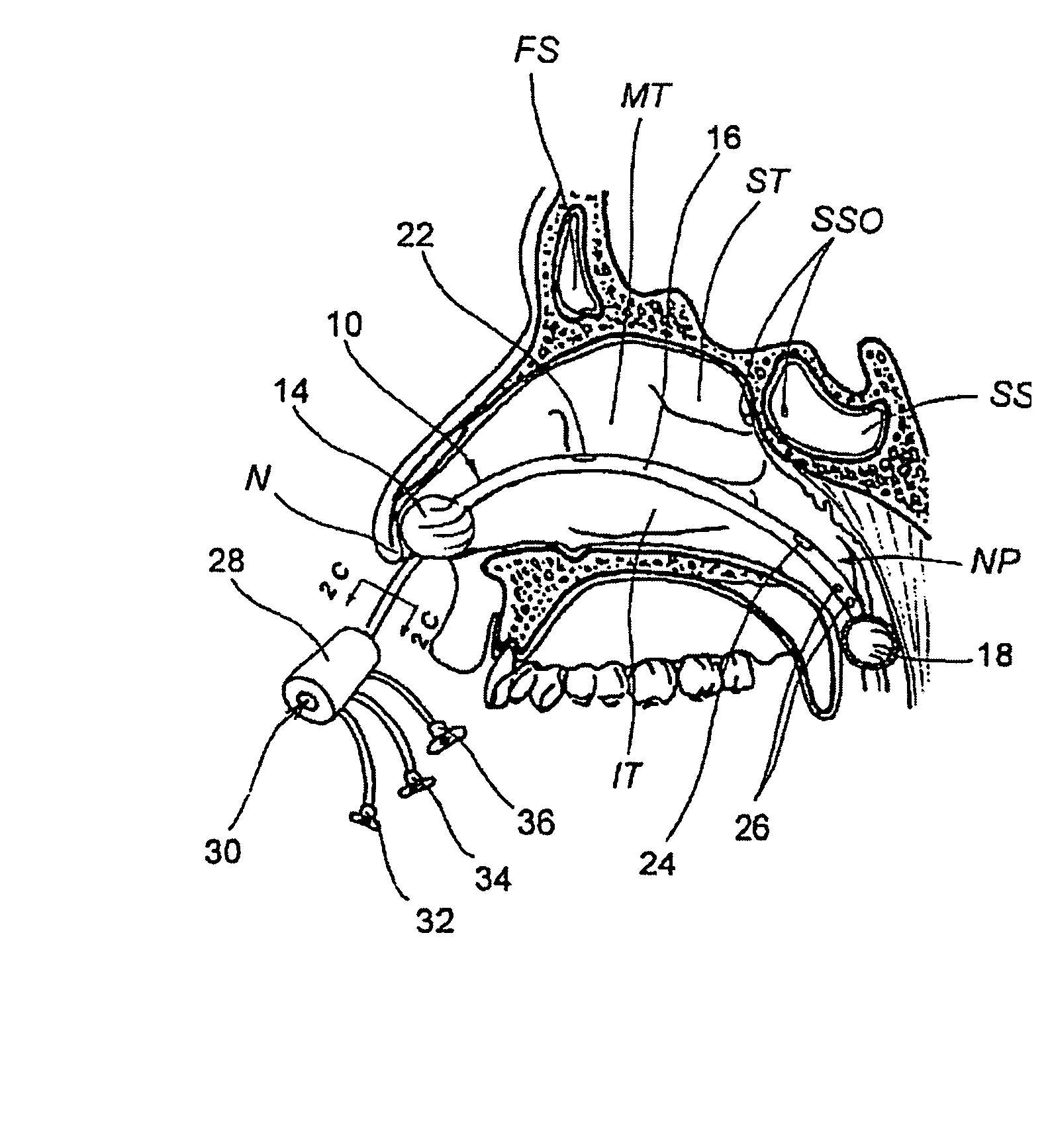 Devices, systems and methods for diagnosing and treating sinusitis and other disorders of the ears, nose and/or throat
