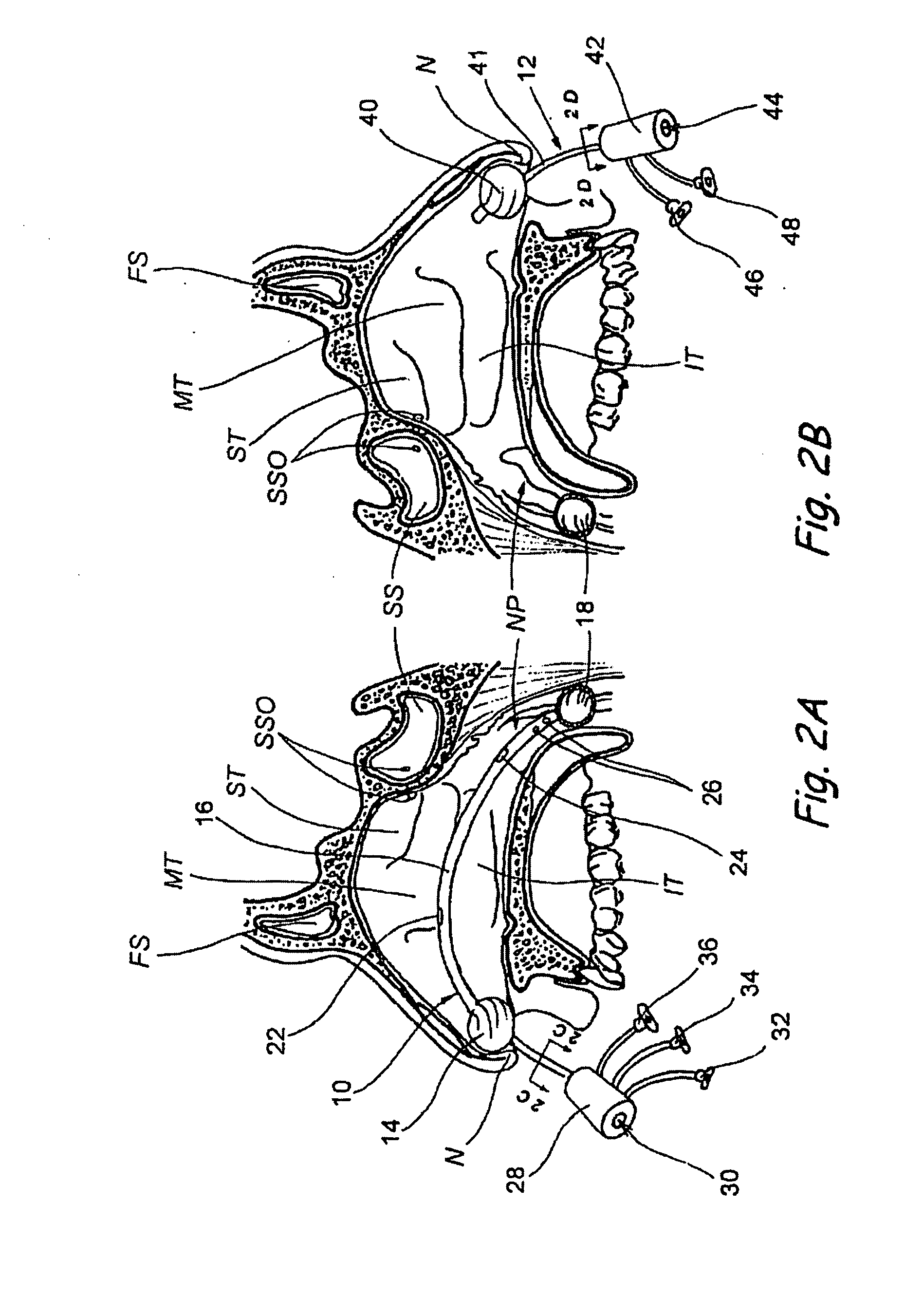 Devices, systems and methods for diagnosing and treating sinusitis and other disorders of the ears, nose and/or throat