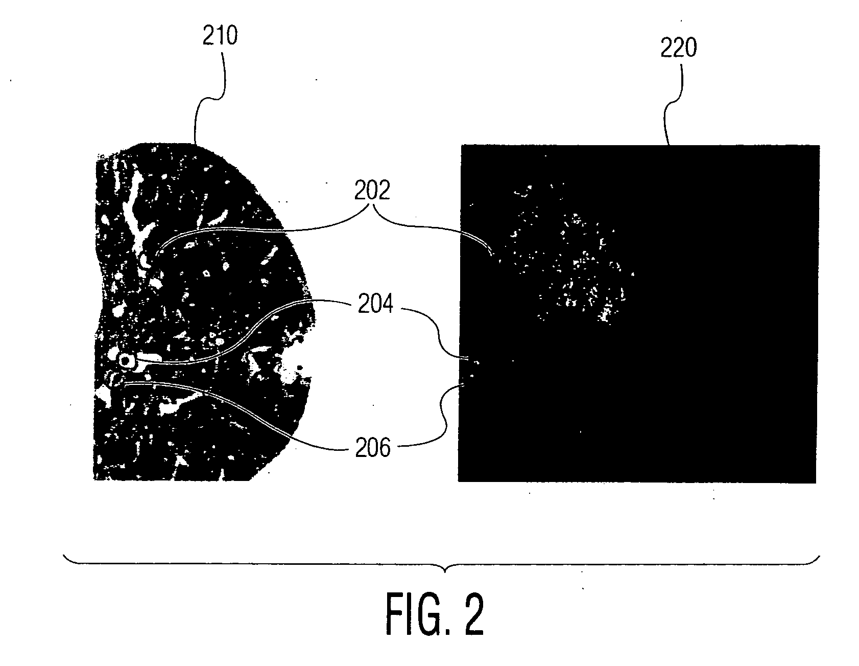 System and method for airway detection