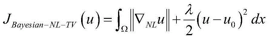 Ultrasonoscopy speckle noise filtering method based on Bayesian model