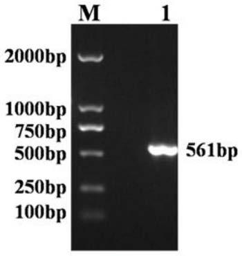 Construction method of toxoplasma gondii SAG2 gene and MIC3 gene recombinant adenovirus, recombinant adenovirus and application