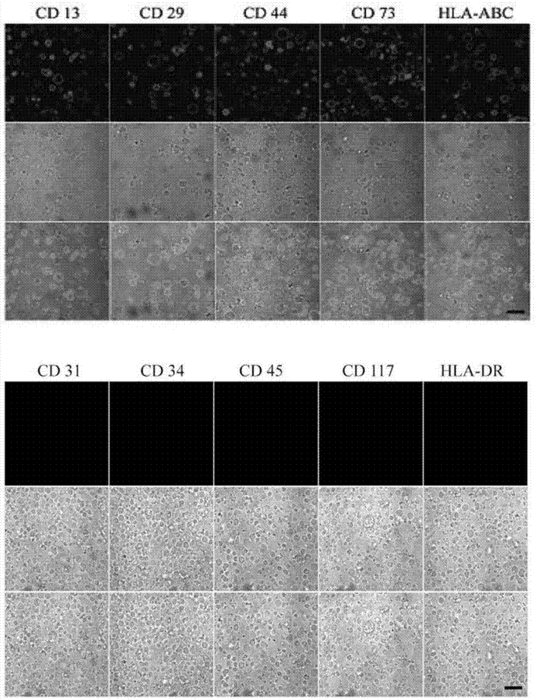 Human umbilical cord mesenchymal stem cell membrane granules, preparation and applications thereof