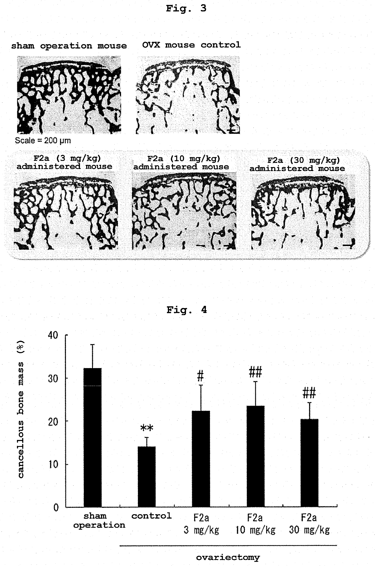 Bone remodeling accelerator