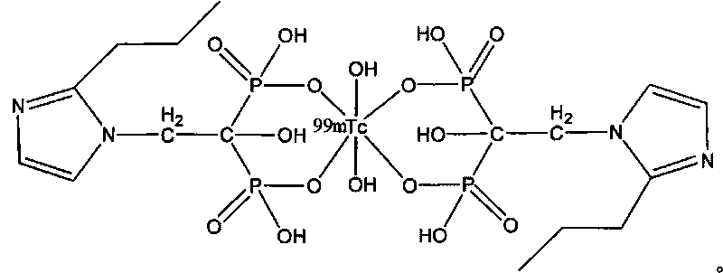 Technetium-99m labeled propyl zoledronic acid composition and preparation method thereof