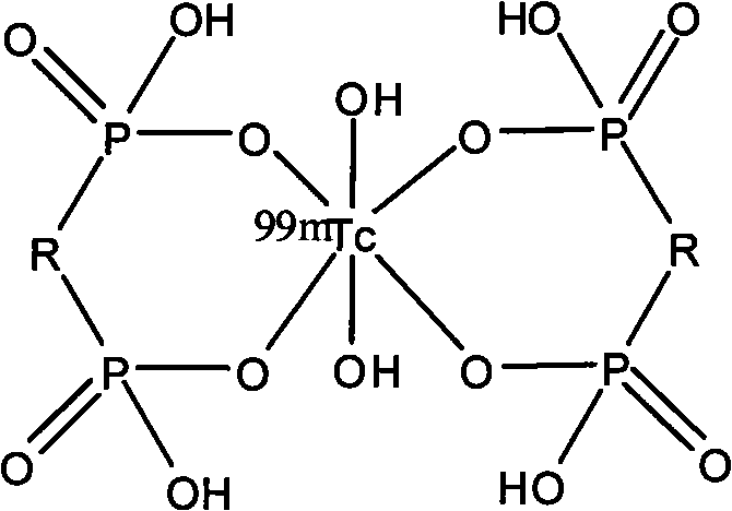 Technetium-99m labeled propyl zoledronic acid composition and preparation method thereof