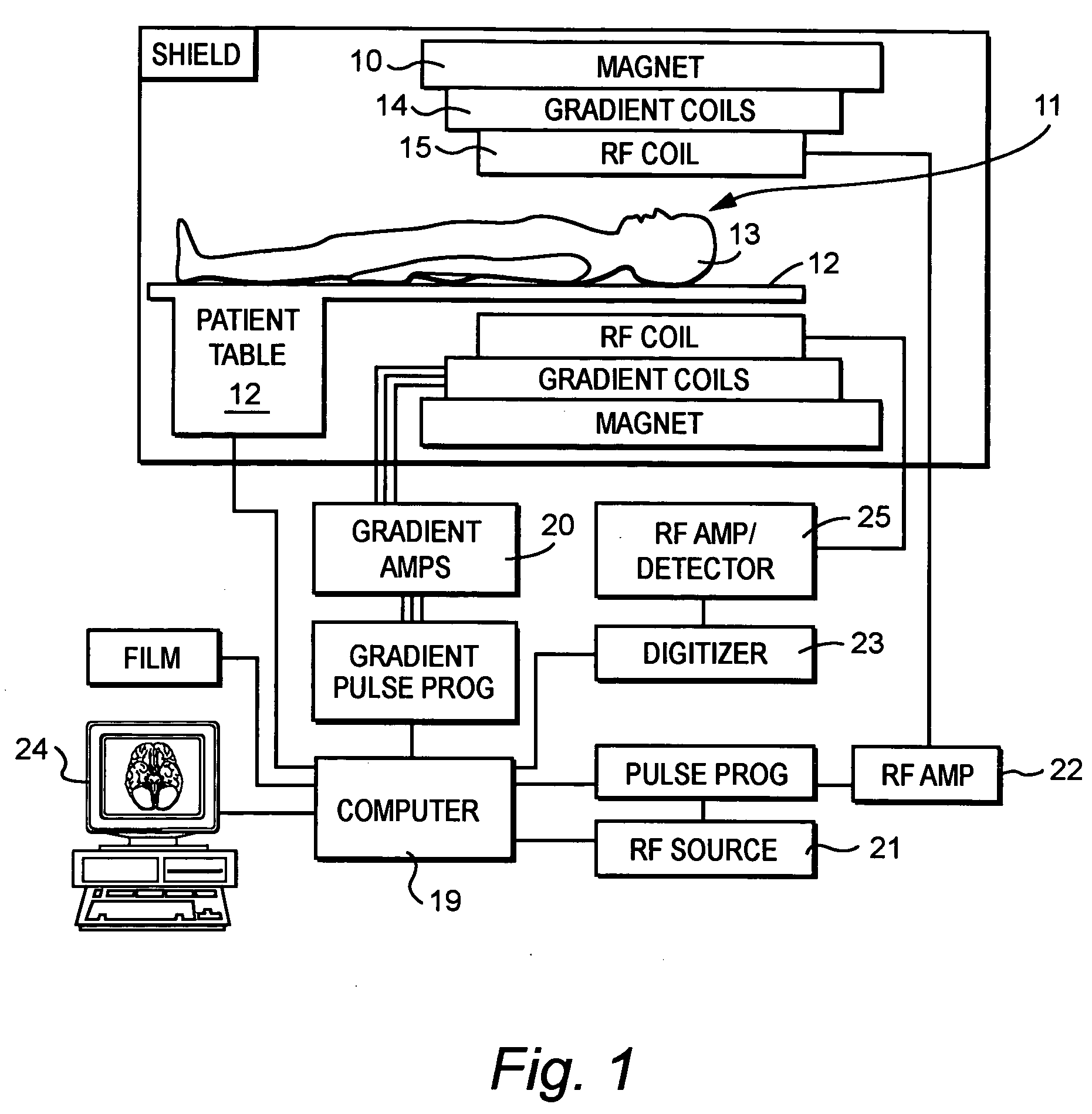 Water fat separated magnetic resonance imaging method and system using steady-state free-precession