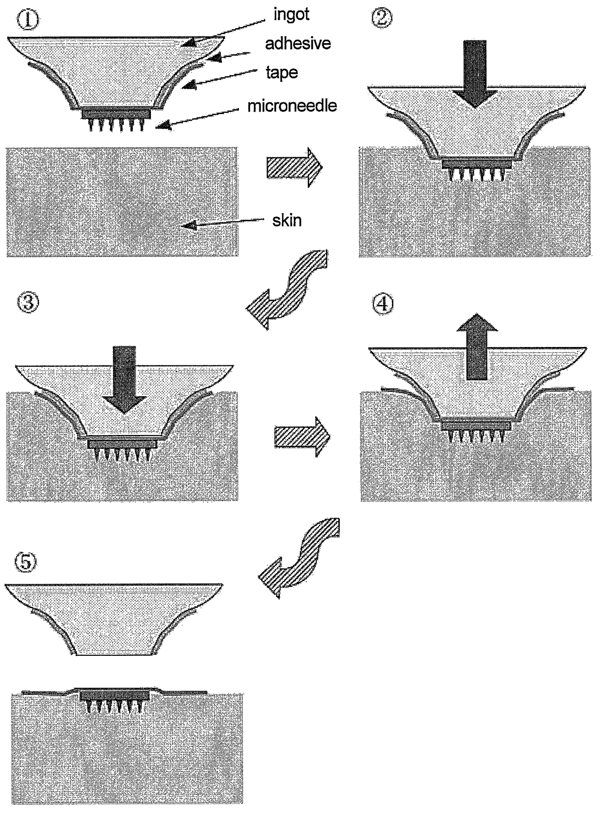 Adhesive patching aid for microneedle adhesive skin patch