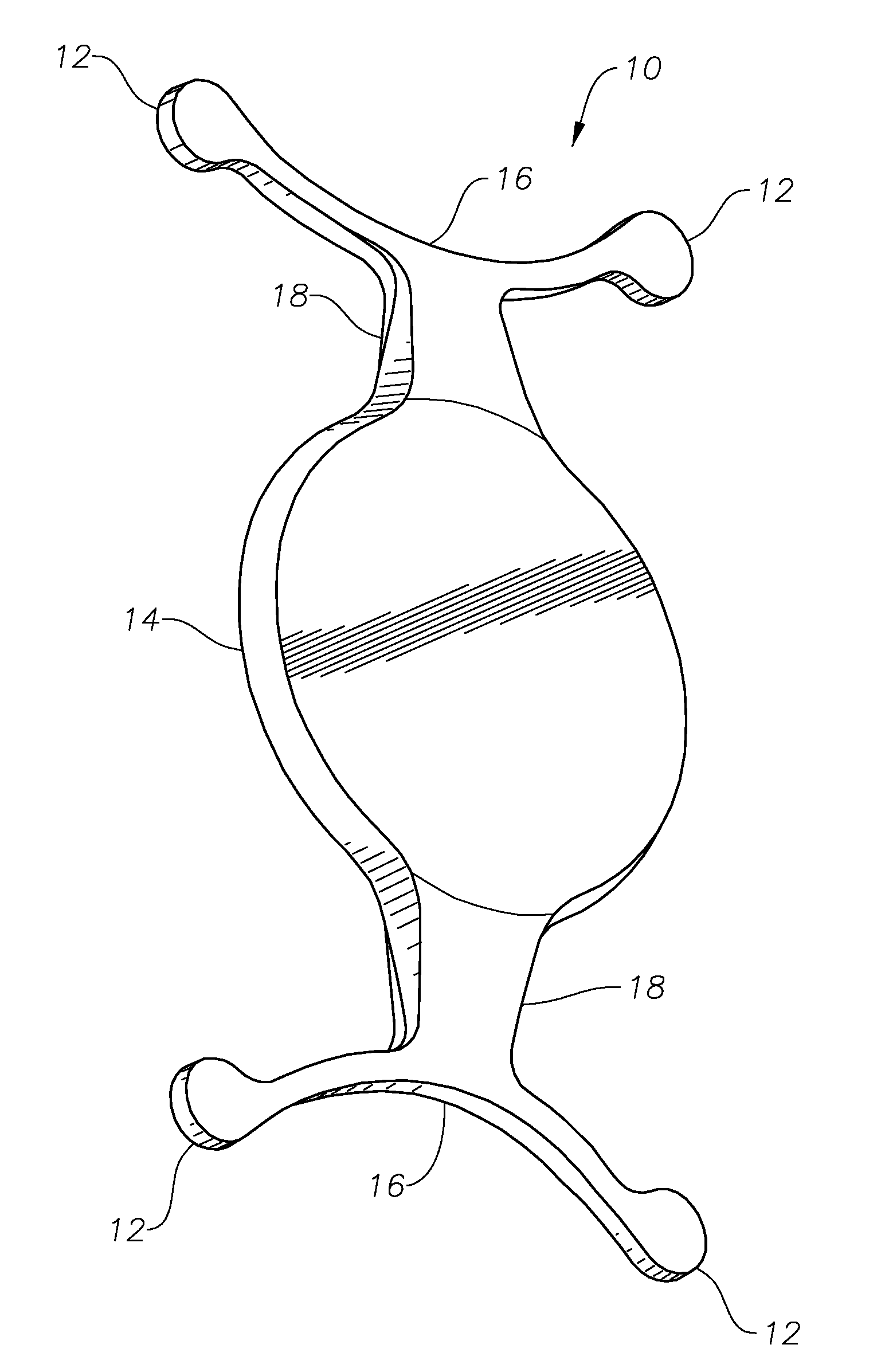 Stable Anterior Chamber Phakic Lenses