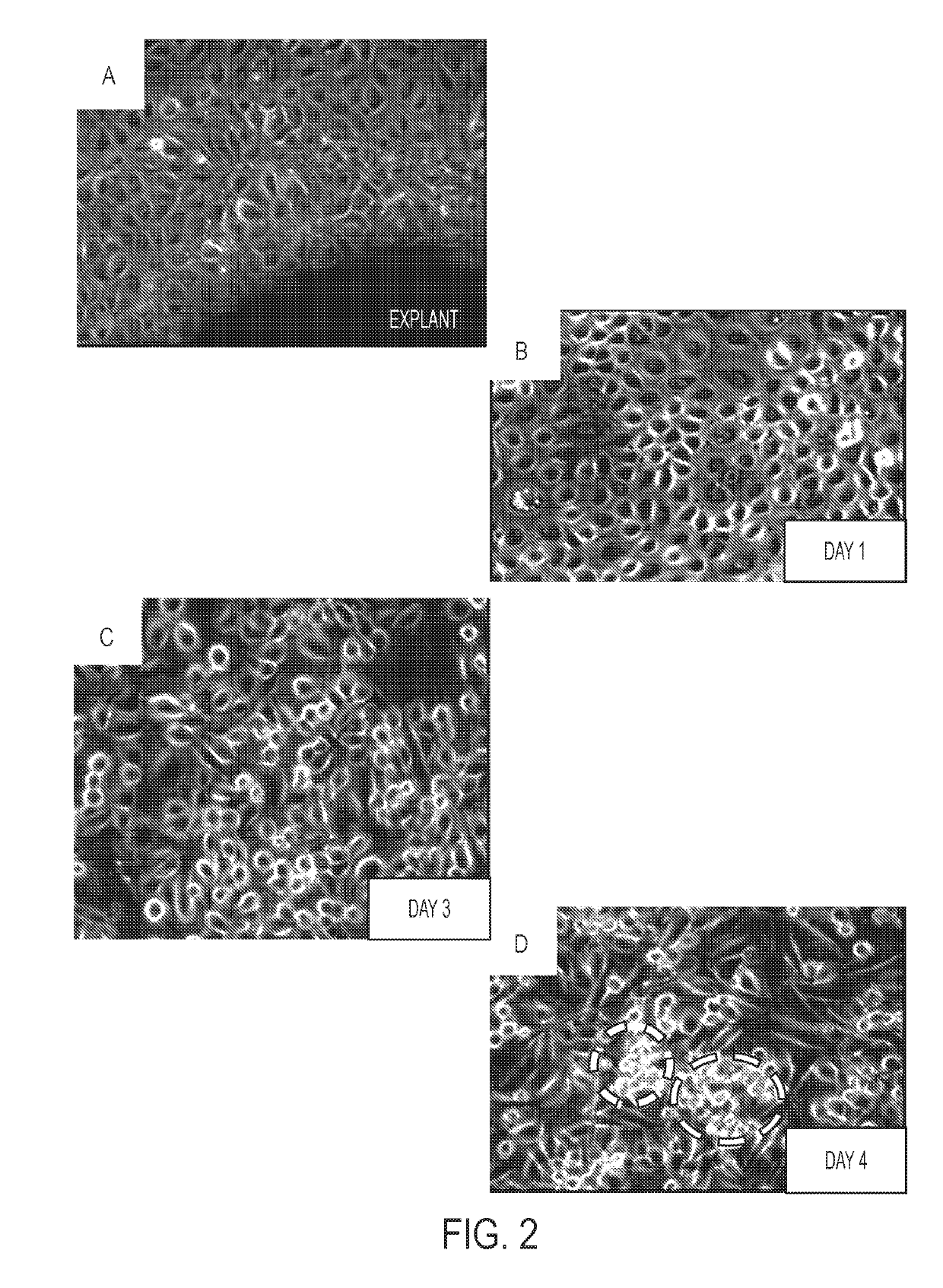 Compositions and methods for vascular protection against reperfusion injury after myocardial ischemia