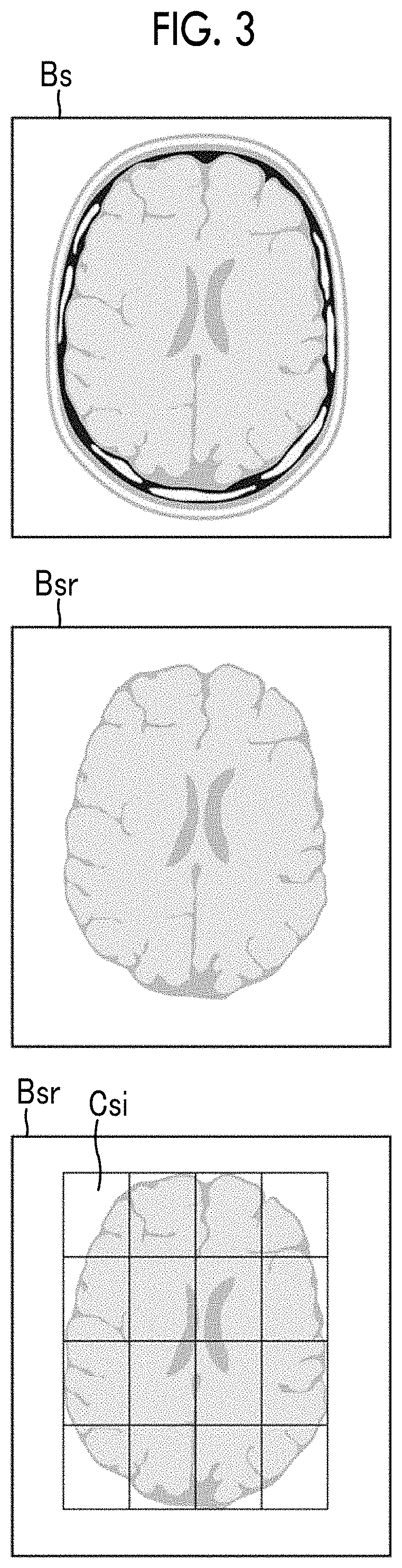 Medical image processing apparatus, medical image processing method, and medical image processing program