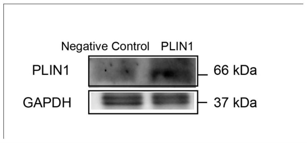 Application of perilipin1 expression intervention agent in the preparation of anti-hepatic fibrosis drugs