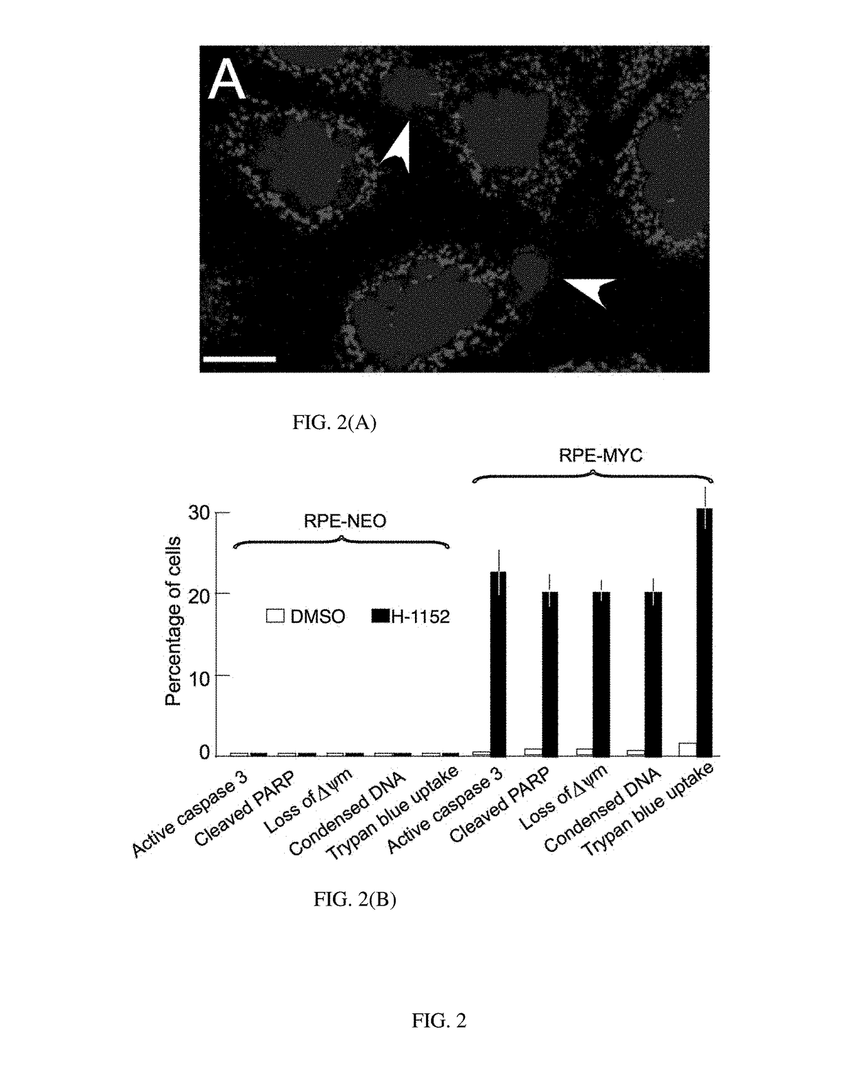 Process for Exploiting Synthetic Lethality Based on OverExpression of MYC Oncogene