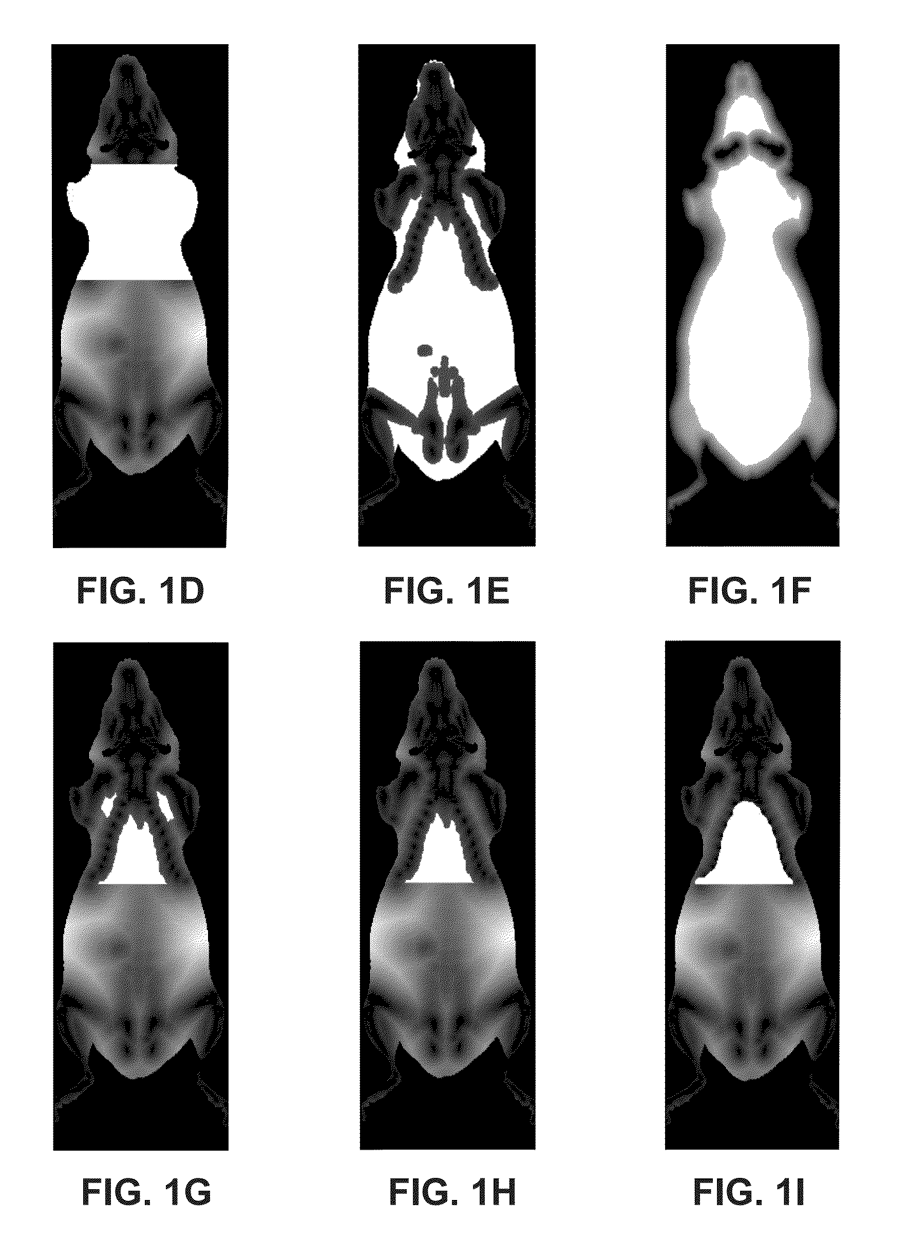 Method and system for automated detection of tissue interior to a mammalian ribcage from an in vivo image