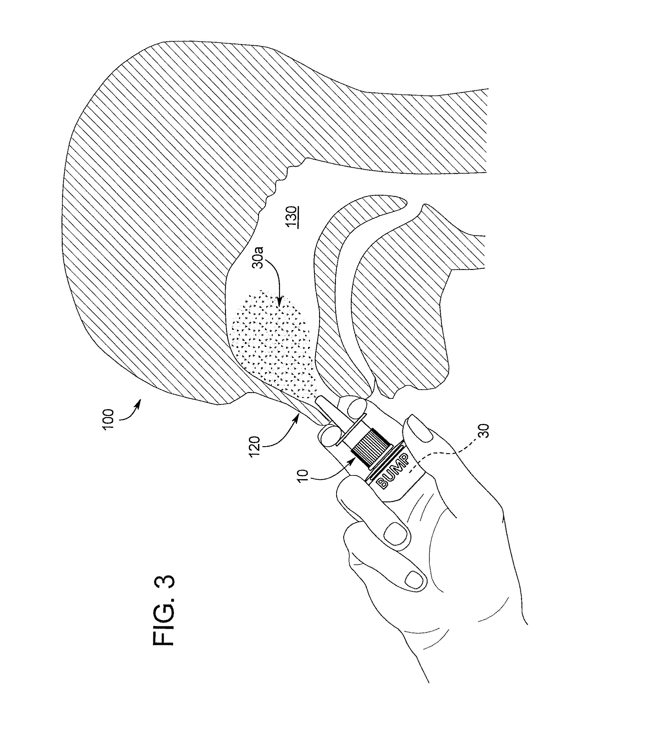 Sprayable oxygenated saline composition and method for treating nasal congestion, allergy, dryness, eye irritation, throat irritation, wounds, and skin as applied to human tissues