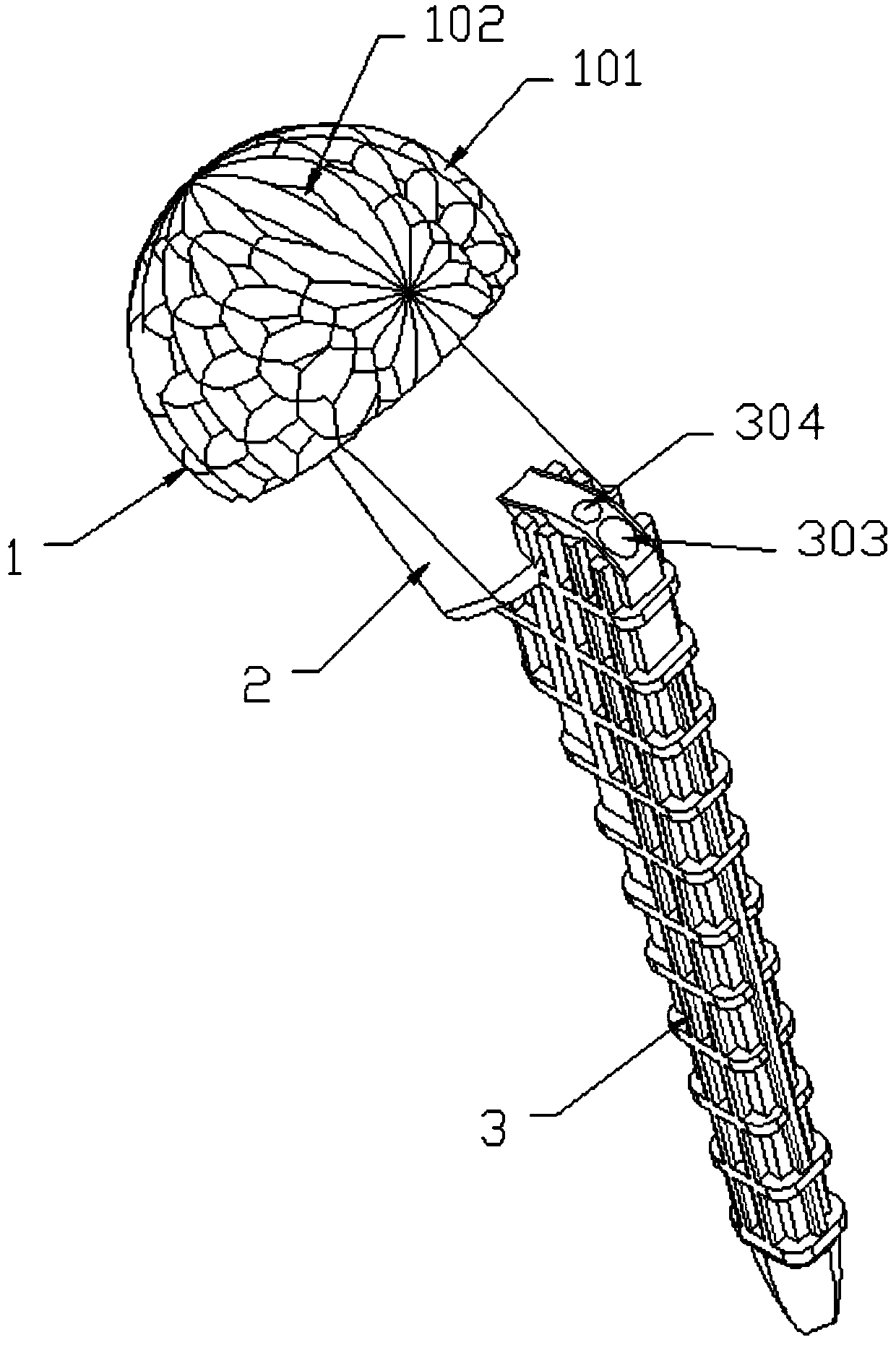 Anti-infective medical temporary prosthesis