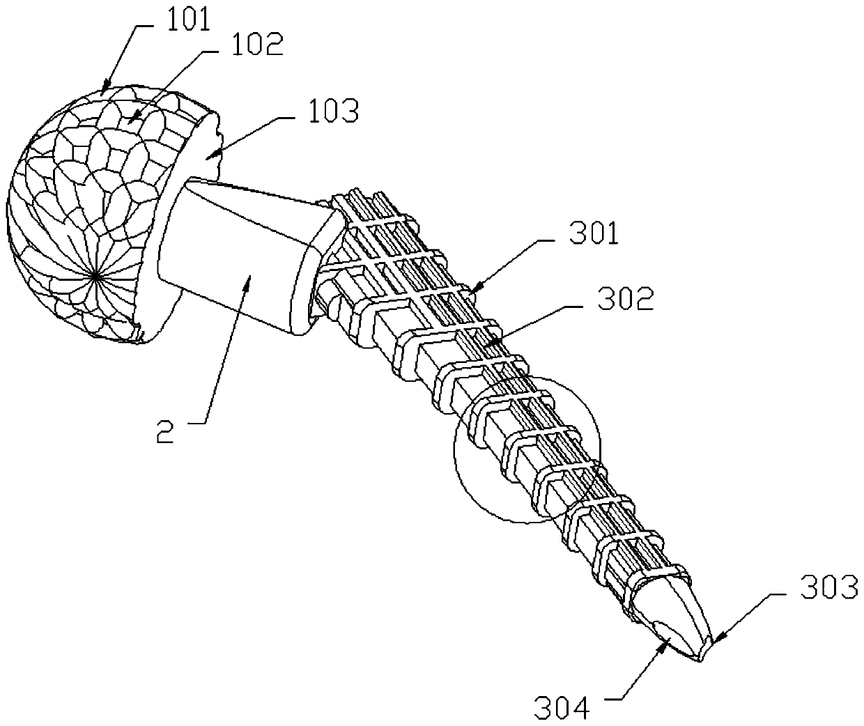 Anti-infective medical temporary prosthesis