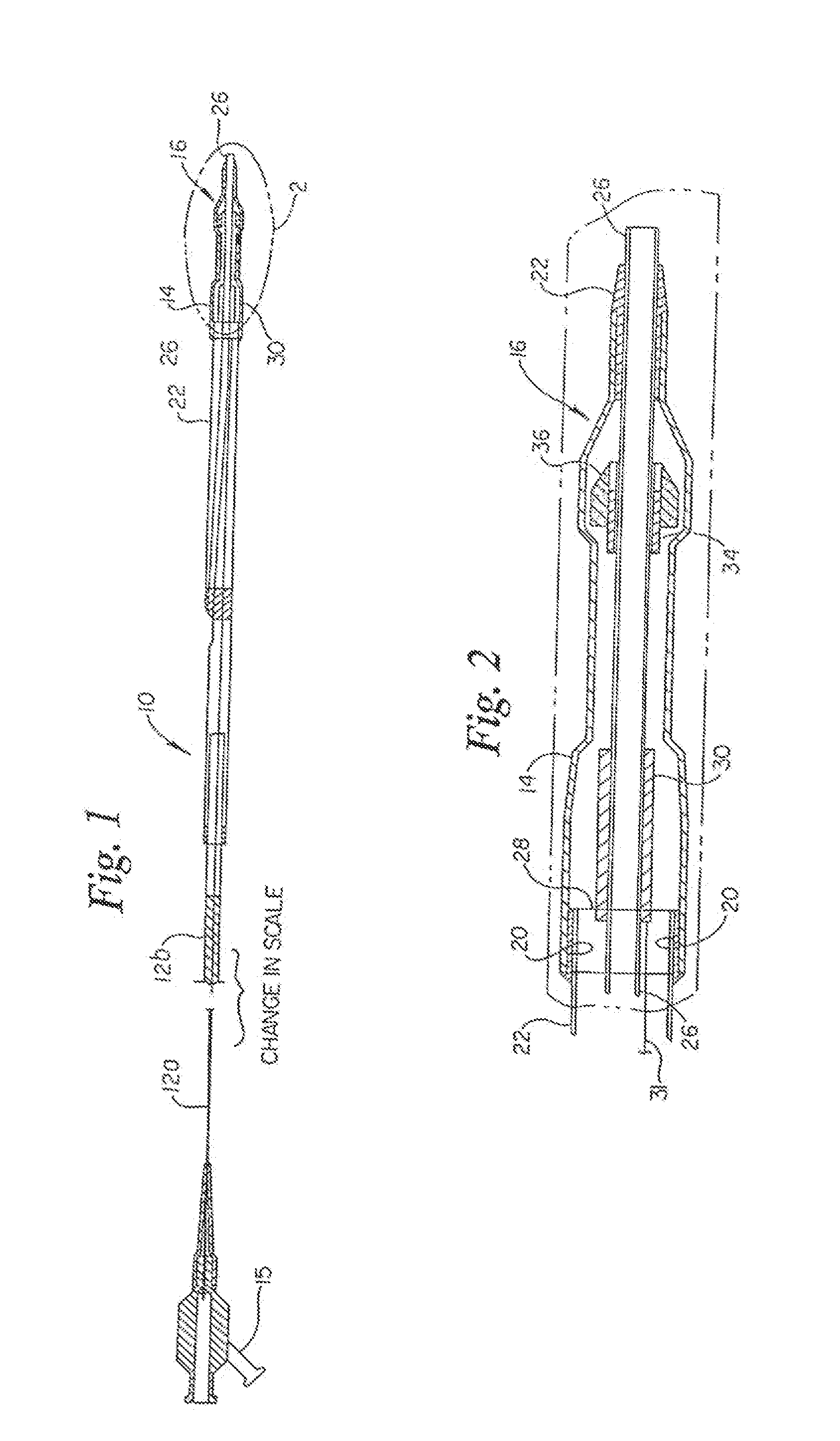Stent Delivery System Having Stent Securement Apparatus