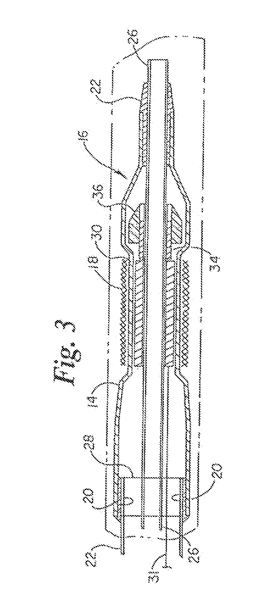 Stent Delivery System Having Stent Securement Apparatus