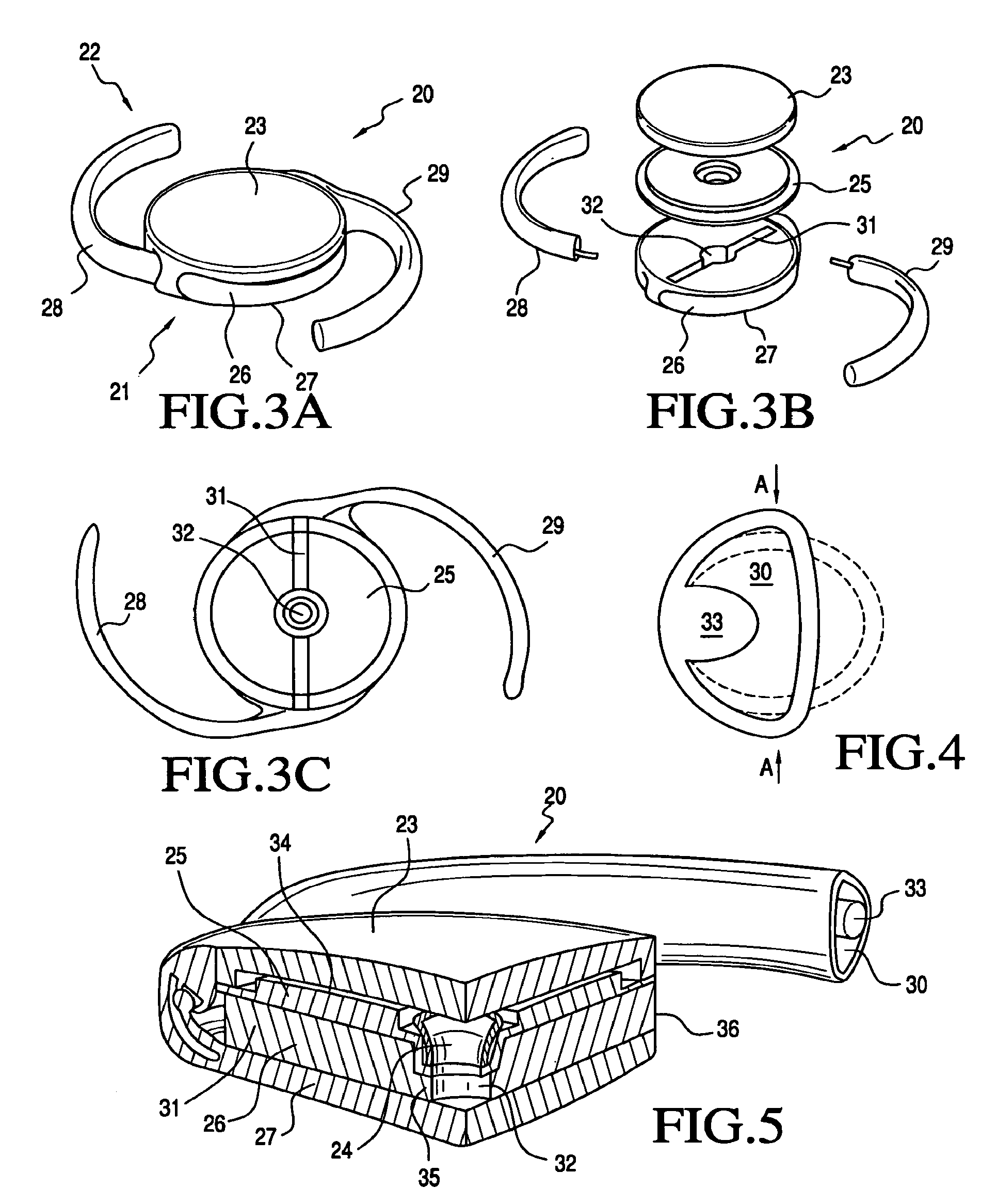 Accommodating intraocular lens system and method
