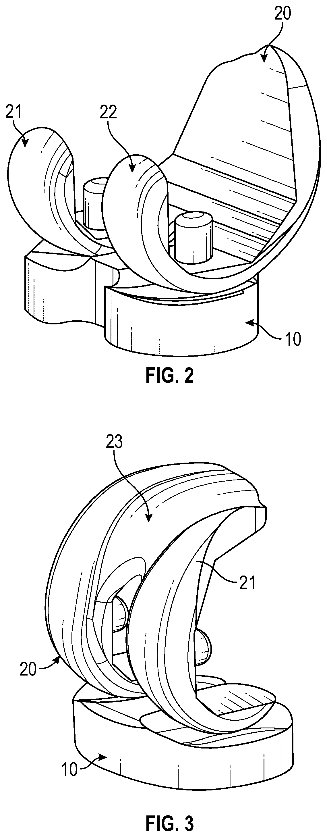 Condylar asymmetry knee prosthesis